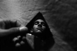 幼児のアトピーに対するステロイド使用は怖い？親の不安を解消する方法は？